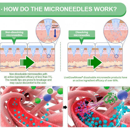 New 2026 Upgrade:LiveGlowRAnew® 6-in-1 Nano Microneedle Patch